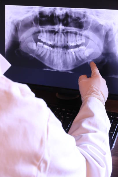 Best Emergency Dental Care for Abscessed Tooth in Coquille, OR